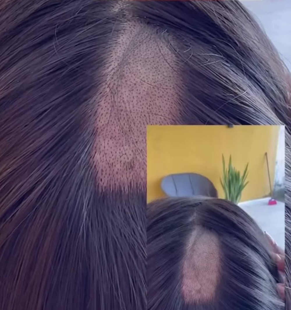 Exame toxicológico para CNH termina com falha excessiva em cabelo de mulher